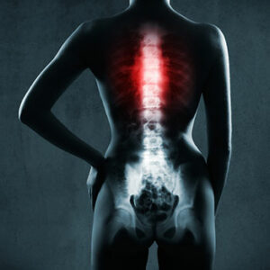 spine damage from accident